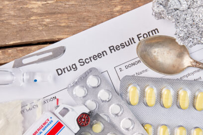 does kratom show up on drug tests?