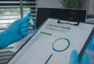 Kratom Lab Test Results - Featured Image